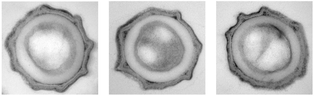 How Dormant Bacteria Return to Life | Harvard Medical School